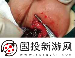 小女孩咬男生睪丸-小女孩調皮咬男生睪丸引發的奇趣故事