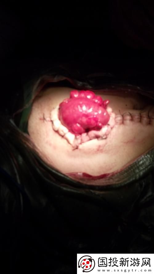 "痛點"里的狂潮-創新界的戲謔風云